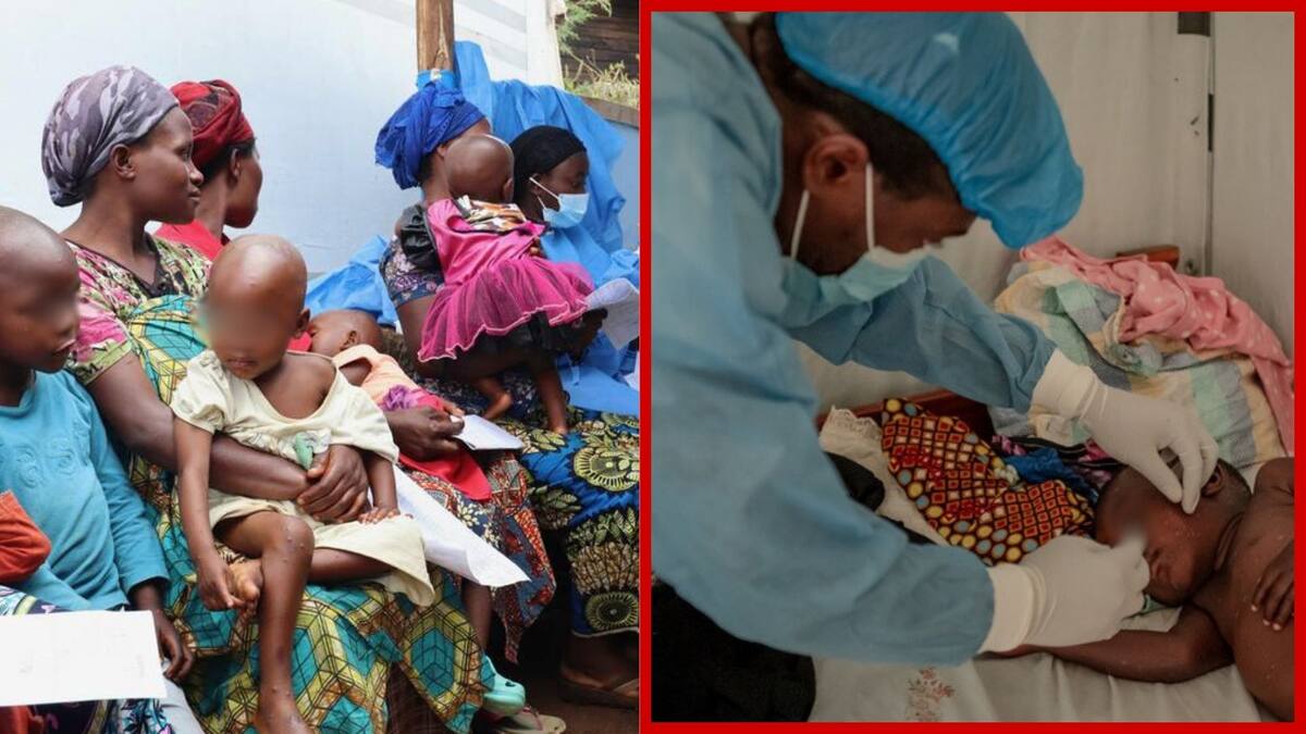África, mpox.