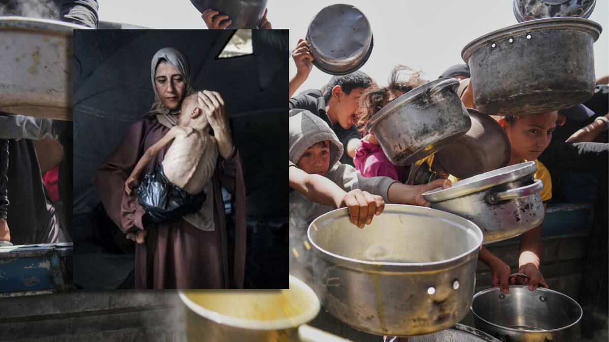 La imagen del niño Muhammad Zakariya Ayyoub al-Matouq refleja la hambruna masiva que se vive entre los habitantes palestinos de la Franja de Gaza que afecta principalmente a menores de edad.| AP y Ahmed Jihad Ibrahim Al-arini / Anadolu, via Reuters