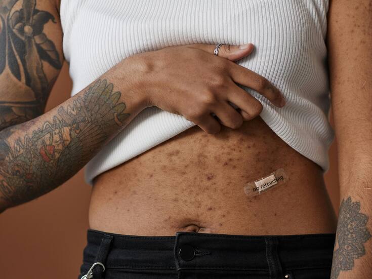 Parche inteligente reduce antojos y emociones negativas en personas en recuperación de adicciones