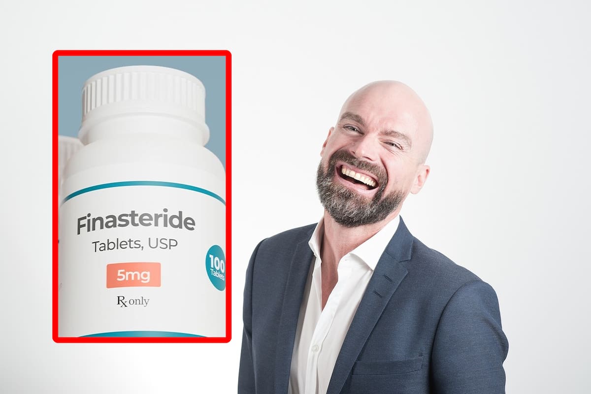 Finasterida: Cofepris aprueba medicamento contra la calvicie ¿es mejor que el minoxidil?