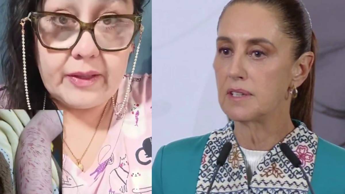 Psicoterapeuta en EDOMEX denunció que su hijo con TDAH se hizo más de 150 cortes en uno de sus brazos por bullying escolar; pide intervención de Claudia Sheinbaum y autoridades