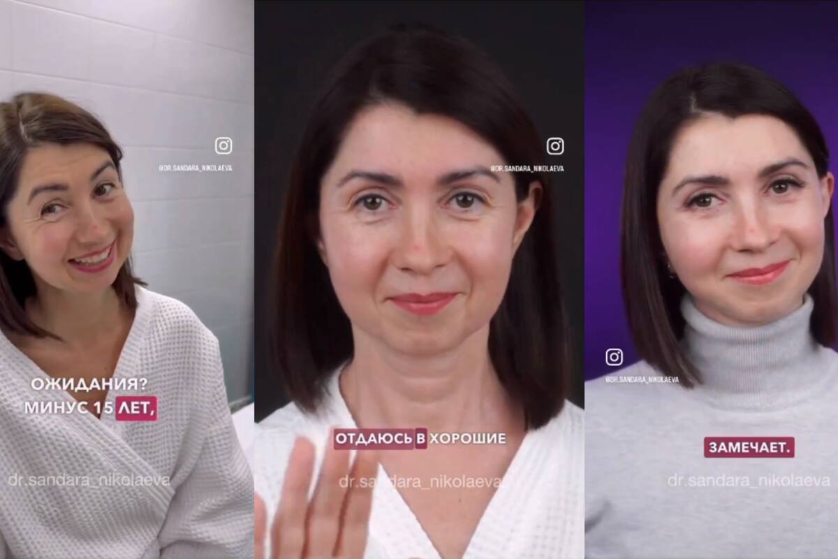 Doctora rusa impacta en redes sociales por el rejuvenecimiento facial que le hizo a una de sus pacientes