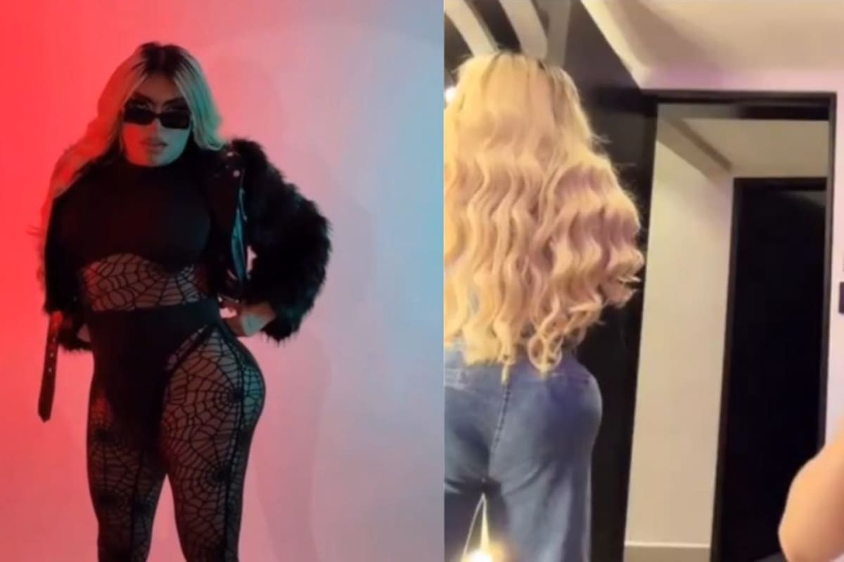 Wendy Guevara desata polémica por el resultado de sus cirugías estéticas