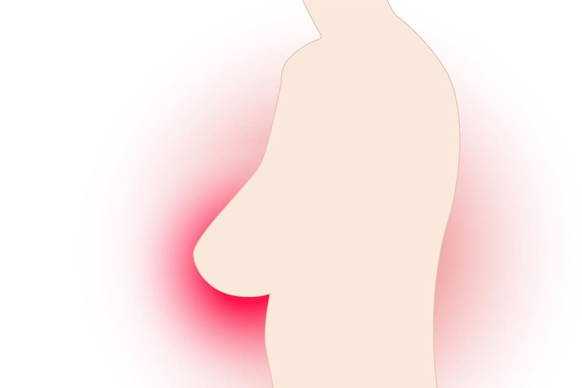 Cáncer de mama registra el mayor número de casos nuevos en México el mundo