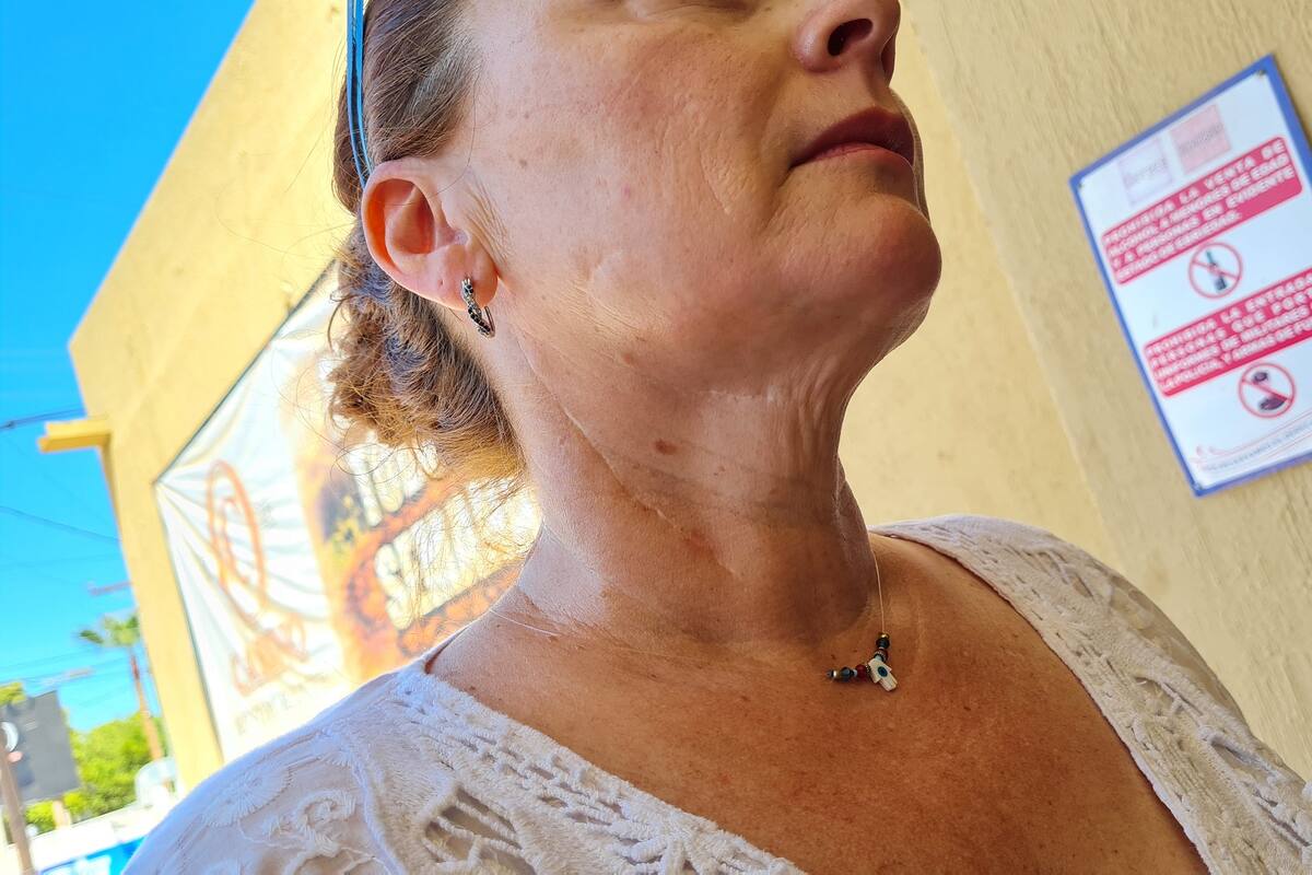 Sobreviviente de feminicidio teme liberación de su agresor
