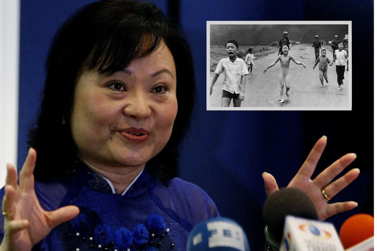 La "niña del napalm" recibirá su último tratamiento contra quemaduras tras 50 años de la icónica fotografía