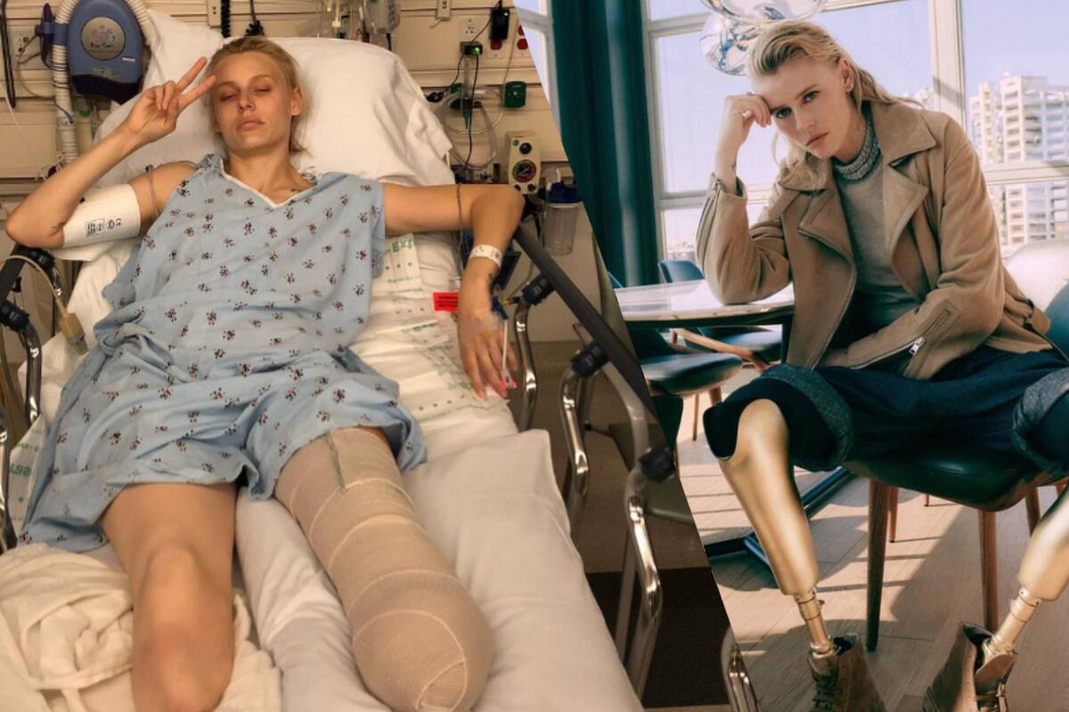 Lauren Wasser: la famosa modelo a la que le amputaron ambas piernas por usar tampones