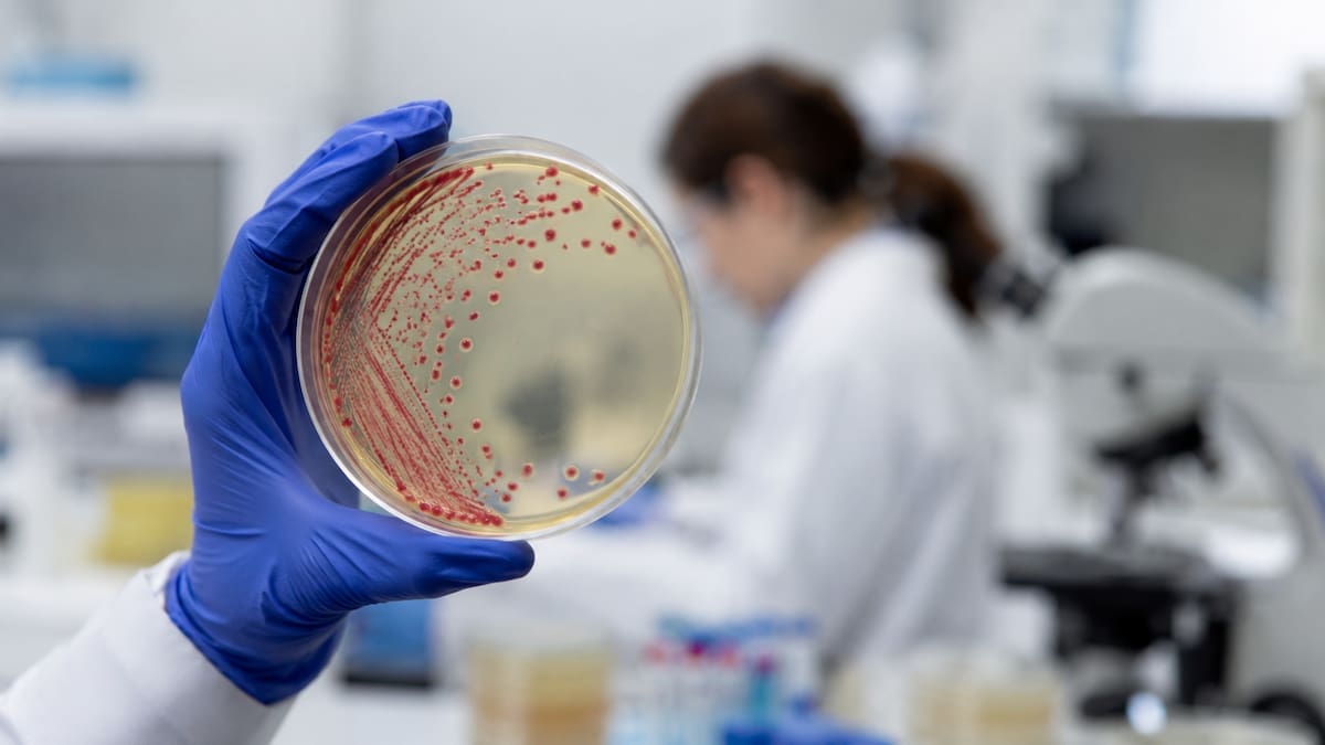 Una muestra de laboratorio permite identificar bacterias relacionadas con infecciones gastrointestinales, como Salmonella. | Imagen ilustrativa generada con IA