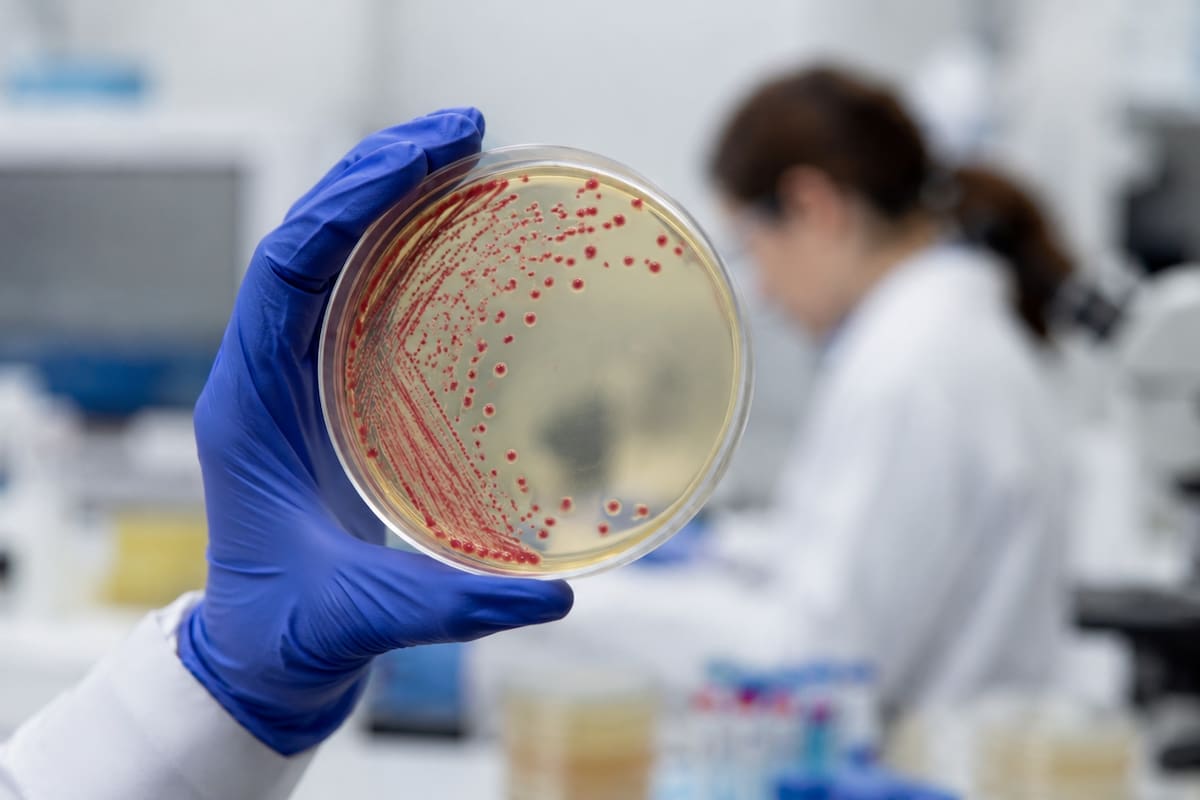 Lo que se sabe del brote de peste en Siberia y que ya cobró la vida de una científica de laboratorio de 28 años y mantiene a 200 personas aisladas