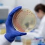Lo que se sabe del brote de peste en Siberia y que ya cobró la vida de una científica de laboratorio de 28 años y mantiene a 200 personas aisladas