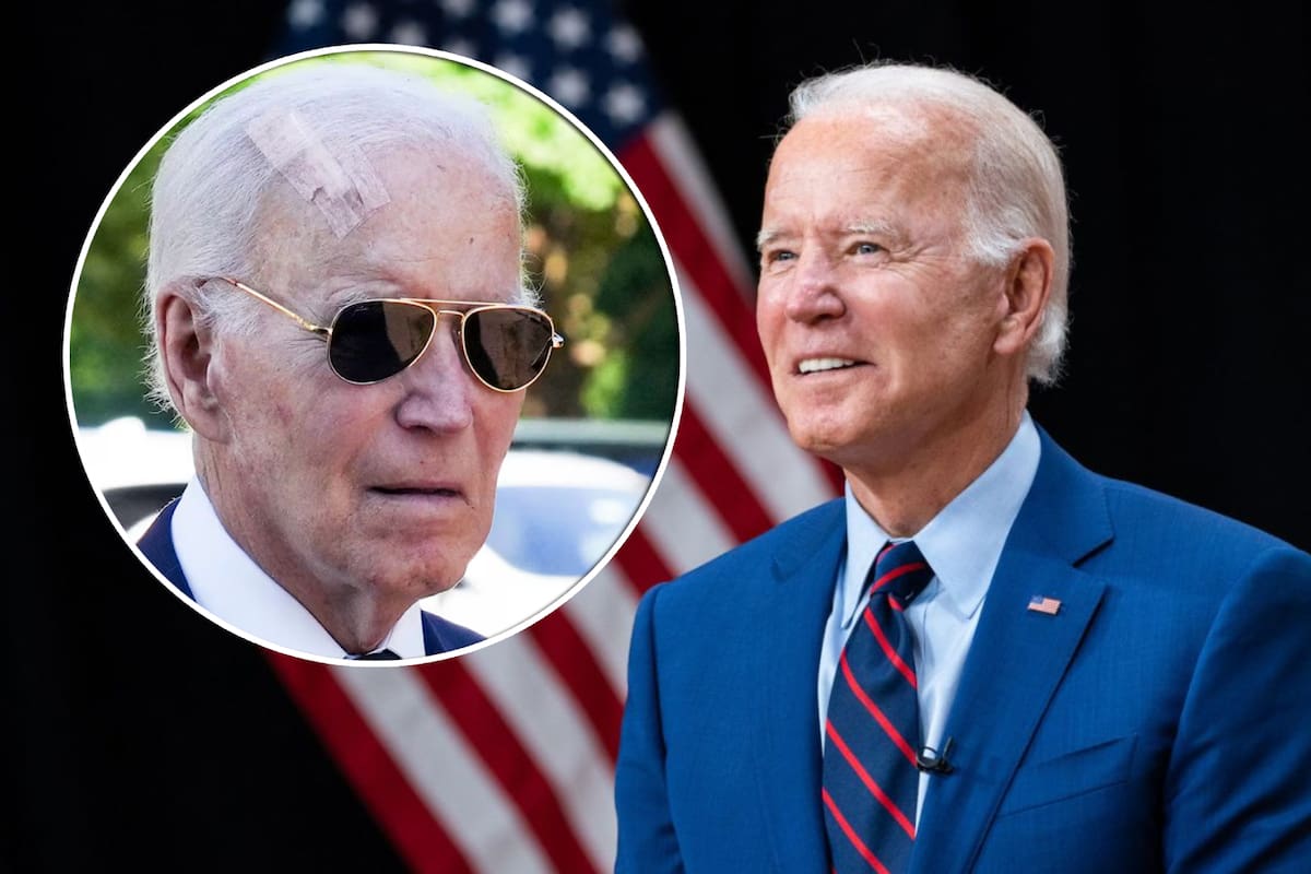 Joe Biden se somete a cirugía para extirpar cáncer de piel y reaparece con vendaje gigante en la cabeza