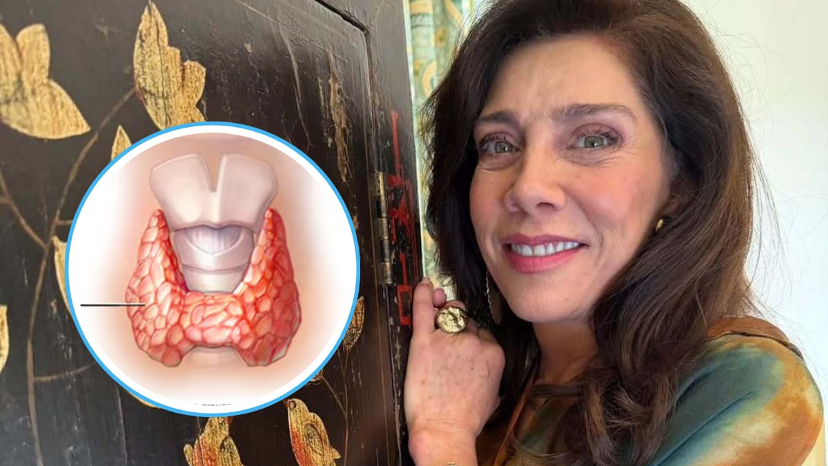 ¿Qué es la enfermedad de Hashimoto? La enfermedad incurable que Cynthia Klitbo reveló tener