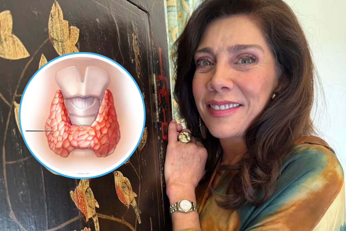 ¿Qué es la enfermedad de Hashimoto? La enfermedad incurable que Cynthia Klitbo reveló tener