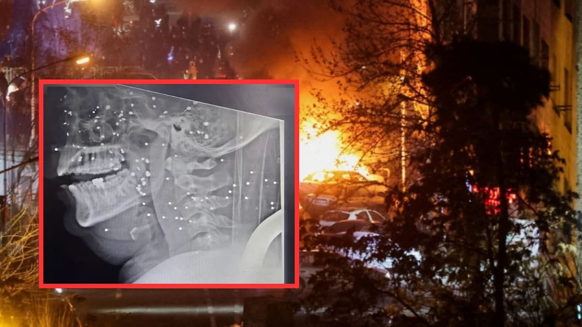 Documentos médicos de Rasht revelan disparos directos a órganos vitales durante protestas en Irán; heridos evitaron recibir atención médica por miedo a ser arrestados