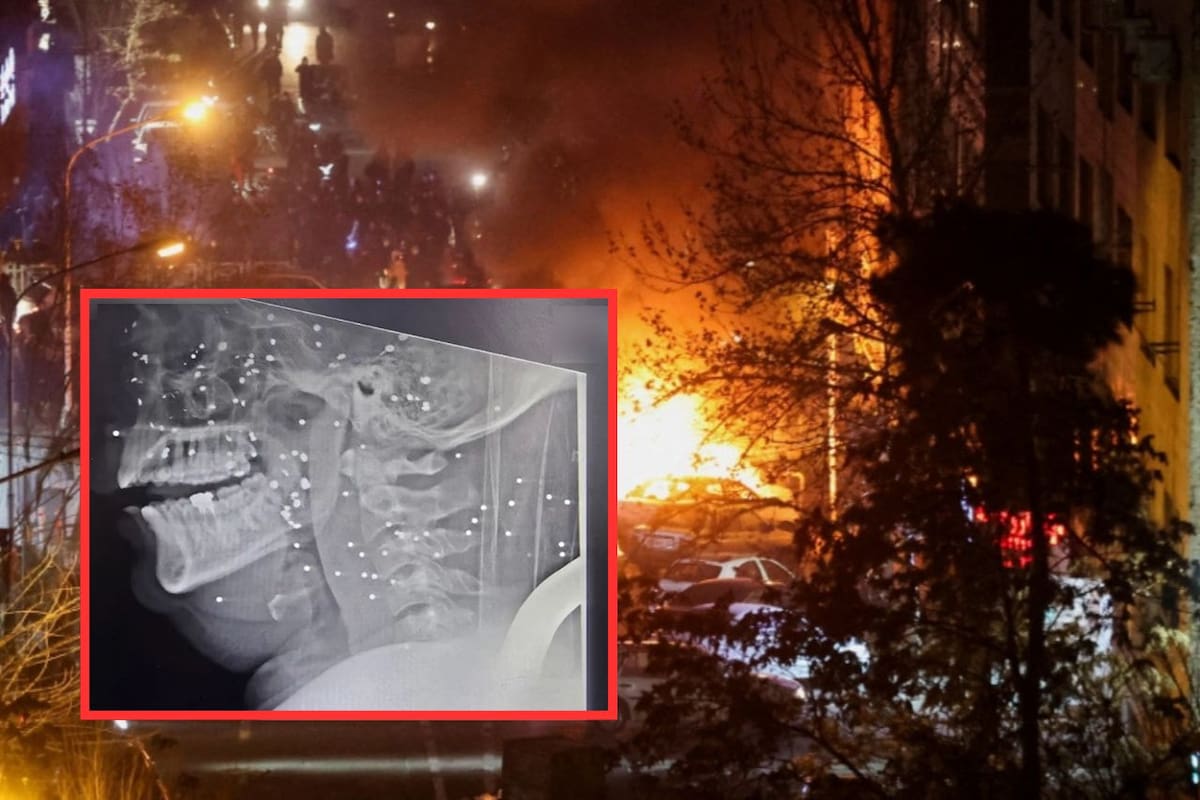 Documentos médicos de Rasht revelan disparos directos a órganos vitales durante protestas en Irán; heridos evitaron recibir atención médica por miedo a ser arrestados