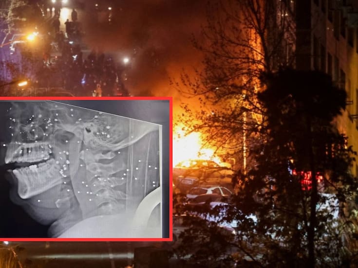 Documentos médicos de Rasht revelan disparos directos a órganos vitales durante protestas en Irán; heridos evitaron recibir atención médica por miedo a ser arrestados