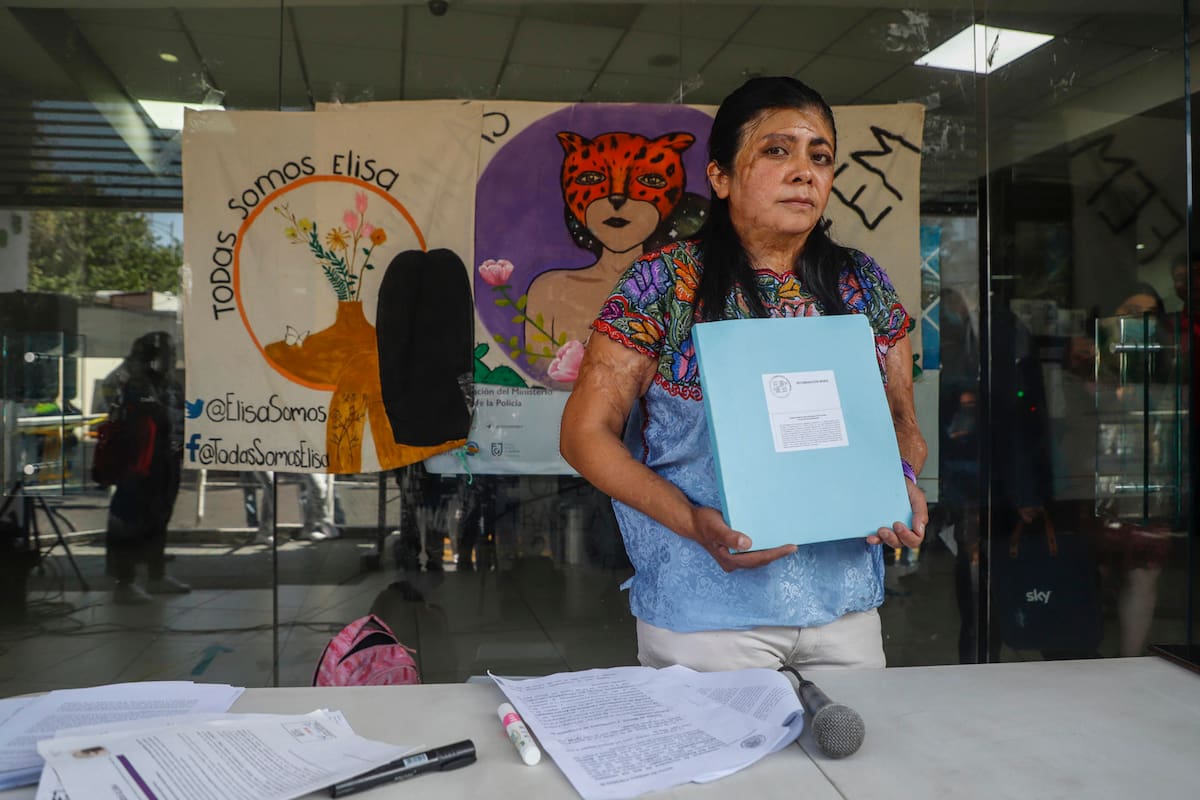 Caso Elisa Xolalpa: Fiscalía de CDMX acepta que dio mala atención a víctima de ataque con ácido en 2001