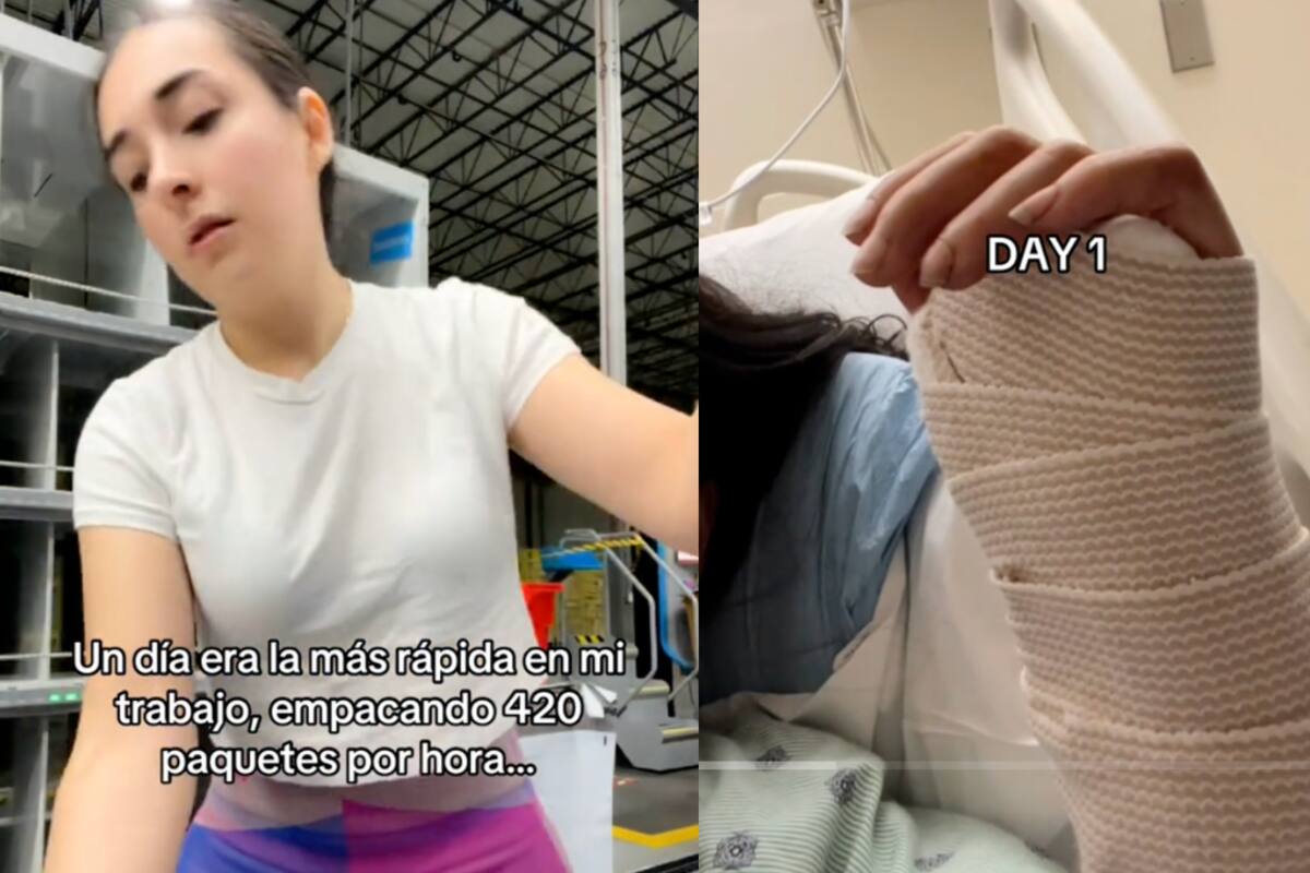 Joven pasa de ser la más rápida en su trabajo a casi perder una mano por un accidente laboral