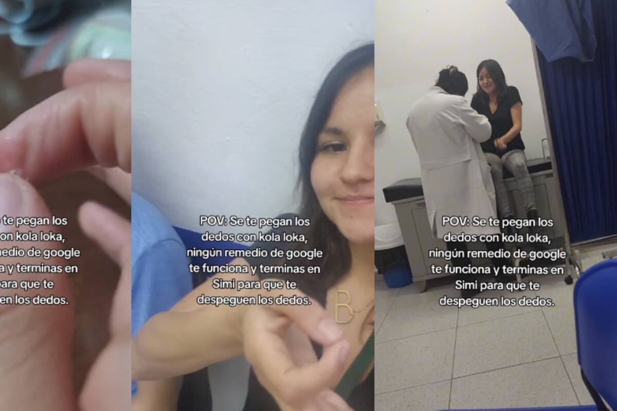 ¡Joven se pega los dedos con Kola Loka y tuvo que ir a consulta médica para despegárselos!