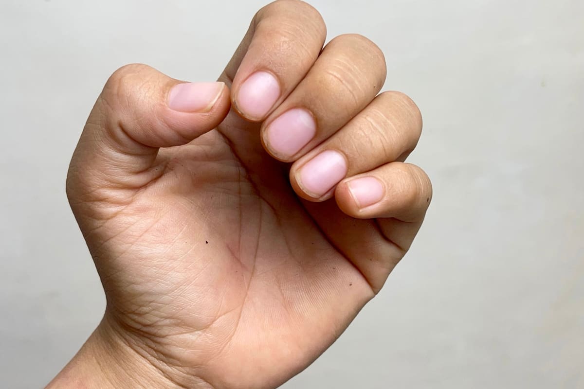 ¿Qué significan las manchas blancas en las uñas? Más allá de un simple golpe