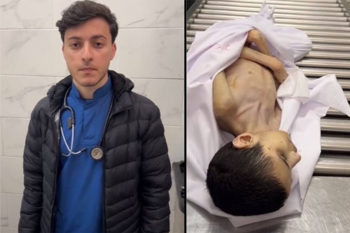 Estudiante de medicina documenta caso de desnutrición infantil en el Hospital al-Shifa