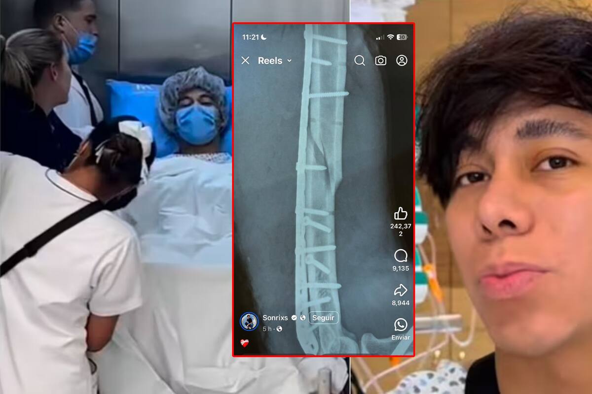 Explica Sonrixs, novio de canadiense, por qué podría perder la movilidad de su mano tras accidente