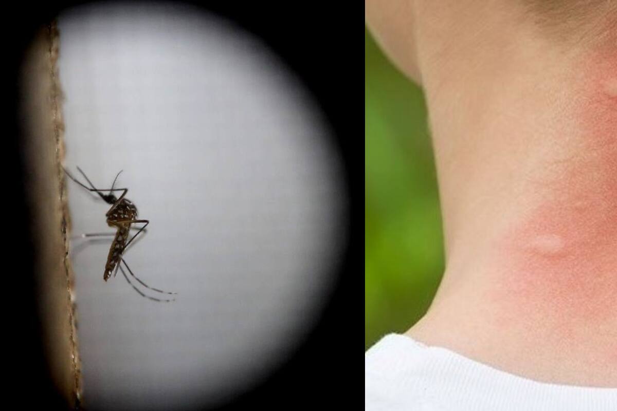 Reportan dos casos de dengue en Navojoa