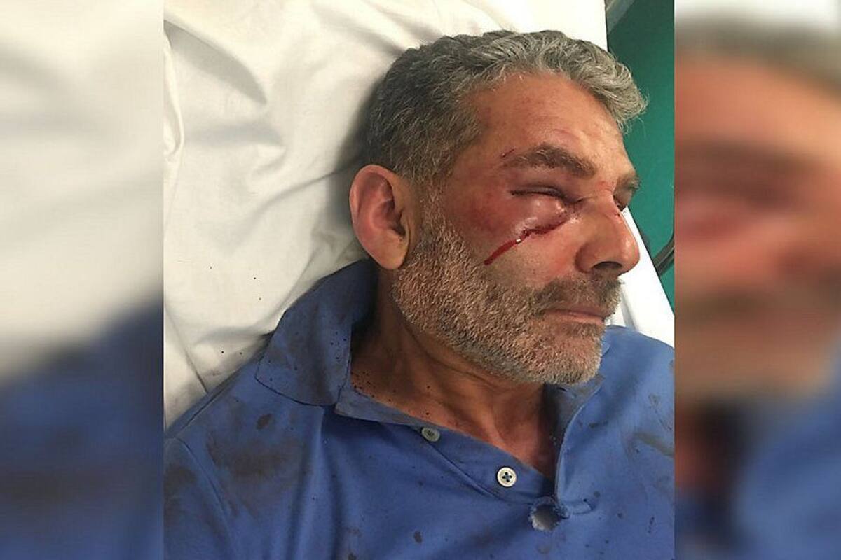 Menores golpean a taxista hispano en Brooklyn