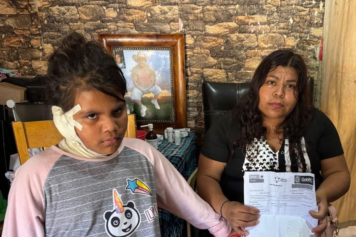 Niña se quemó el 50% de su cuerpo con una sopa caliente
