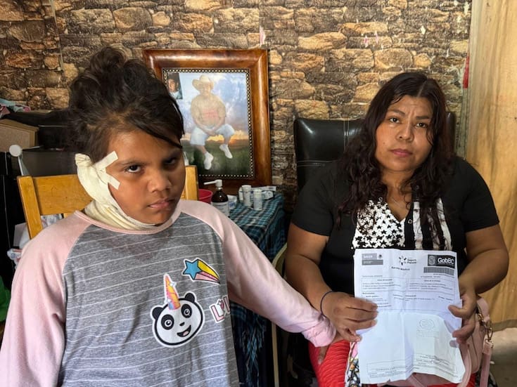 Pide apoyo para tratar quemaduras de su hija