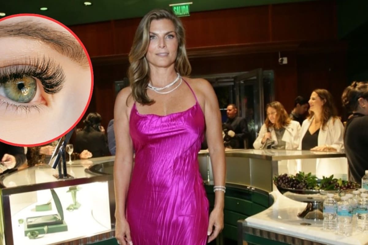 Montserrat Oliver revela que perdió parcialmente la vista por un infarto ocular ¿Qué es esta condición?