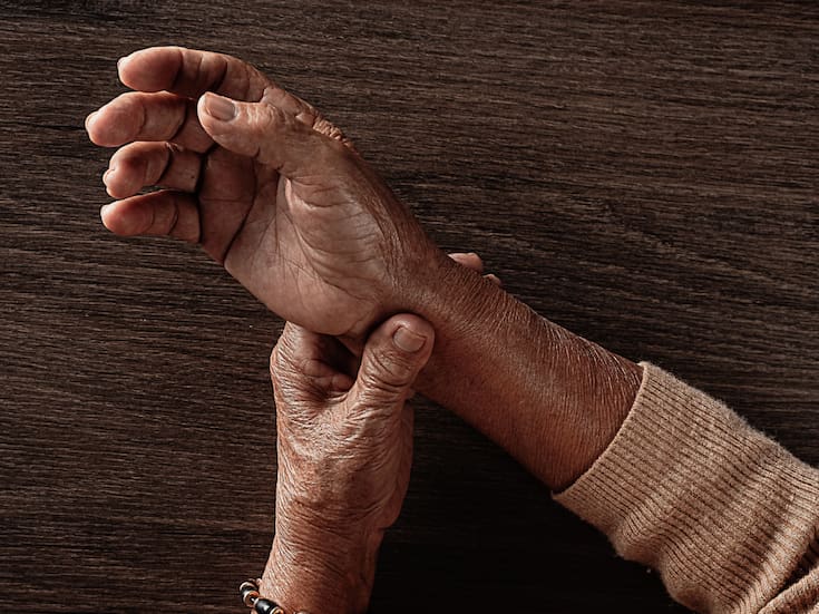 Artritis reumatoide: cómo detectarla antes de que aparezca el dolor