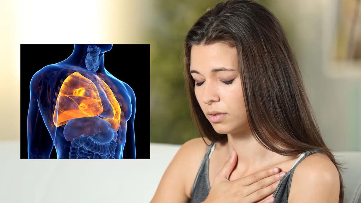 Foto: La voz de Galicia, micancerminutricion.es