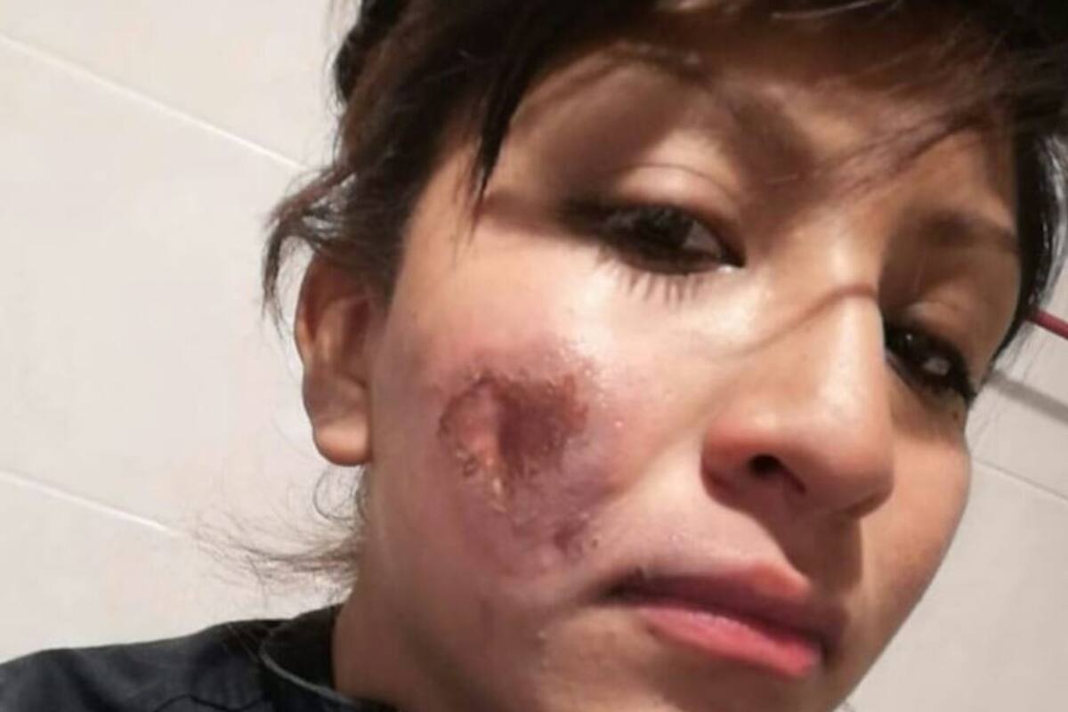 Queman rostro a policía durante marcha del 8 de marzo en la CDMX