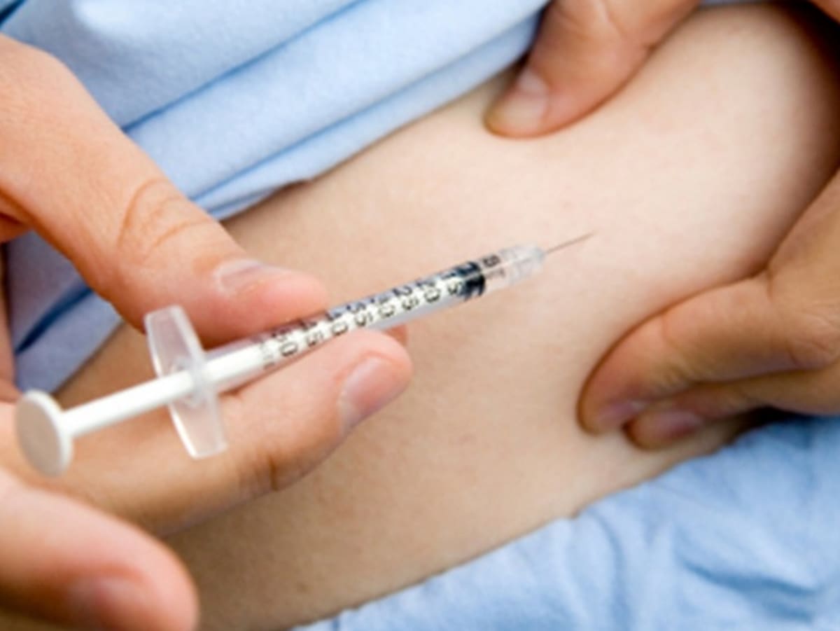 La diabetes mellitus es una enfermedad crónico degenerativa que se presenta cuando el páncreas no produce insulina.