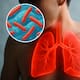 ¿Qué es la tuberculosis y como puedo identificarla?