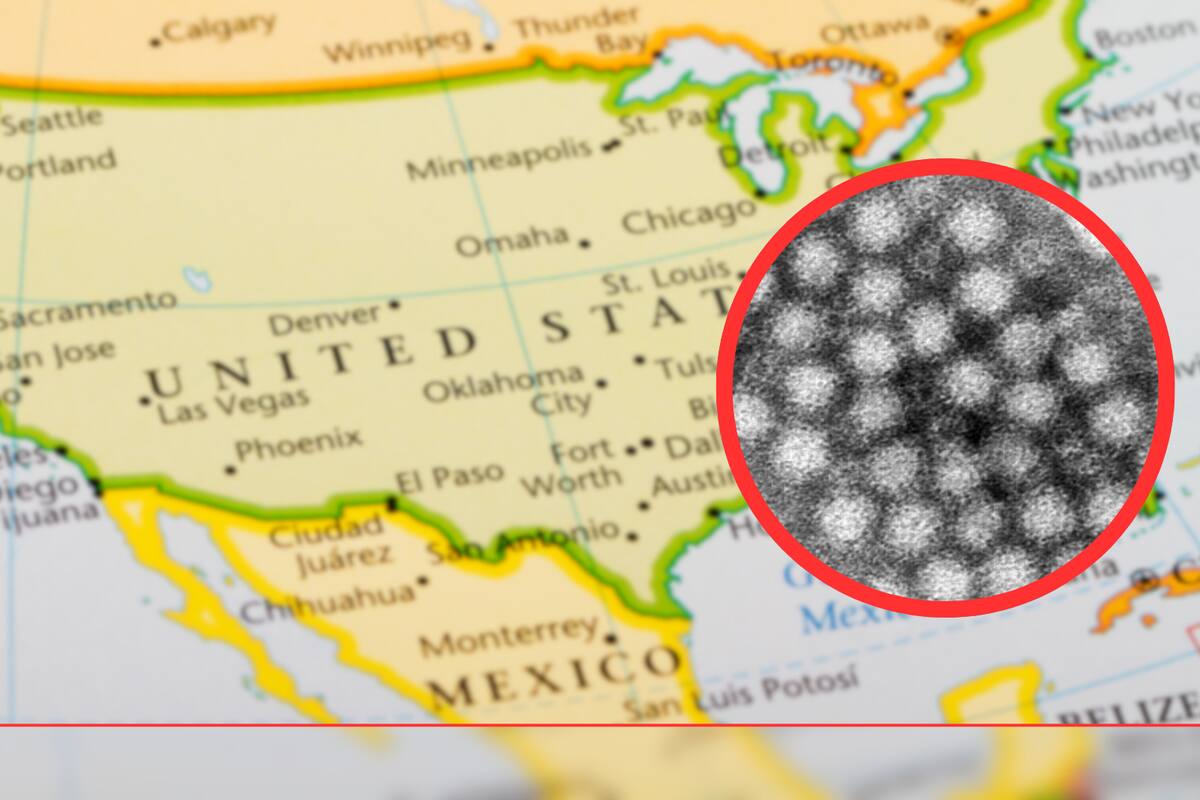 ¿Qué es el ‘Norovirus’, el mortal virus altamente contagioso que aumenta brotes en EU este invierno?