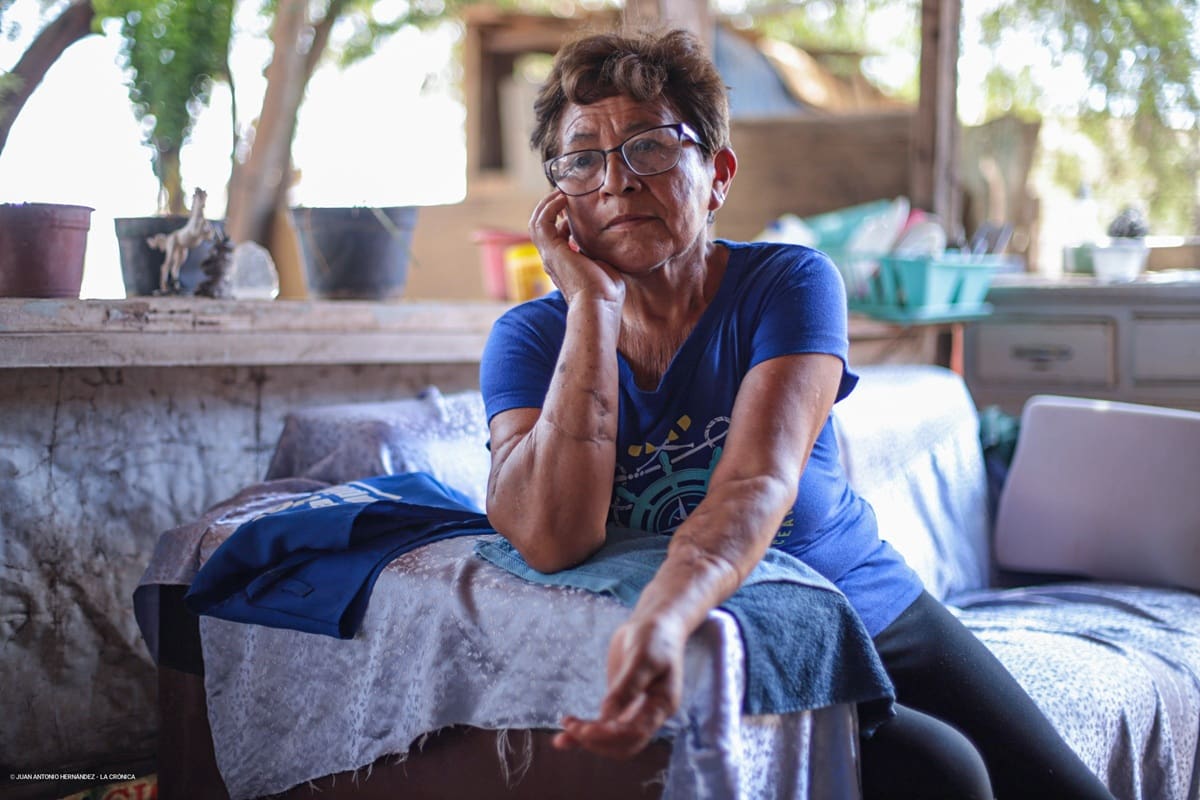“Mi vida ya no es la misma”: mujer sobrevivió al ataque de cinco pitbulls