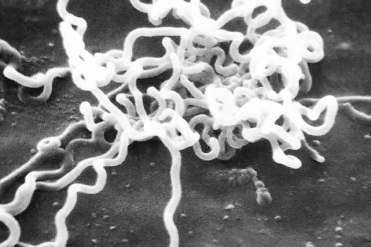 ¿Qué es la sífilis y cómo saber si la tengo?