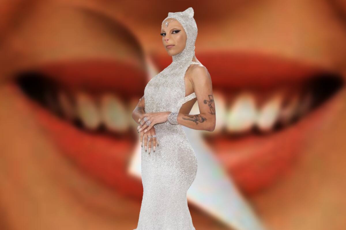 ¿Le arrancaron a Doja Cat sus dientes? Esto se sabe de la agresión de su hermano