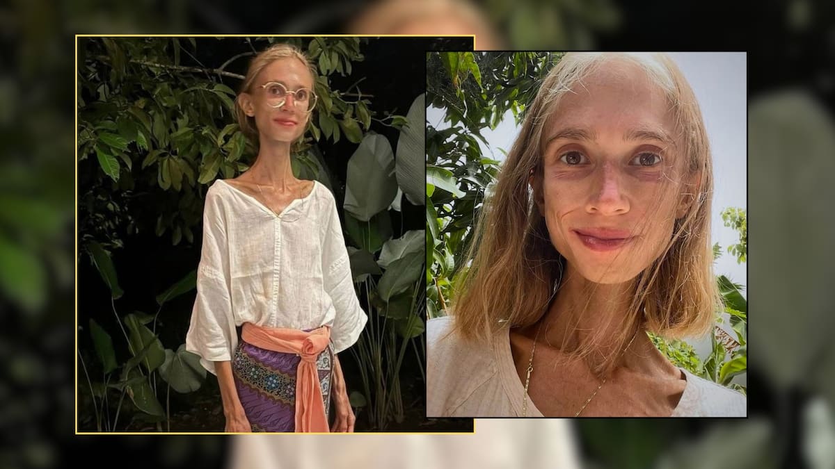 Influencer polaca que solo comía frutas crudas murió por desnutrición extrema en una reunión con otras personas que compartían su estilo de vida fuera de su país; tenía 39 años y pesaba 22 kilos