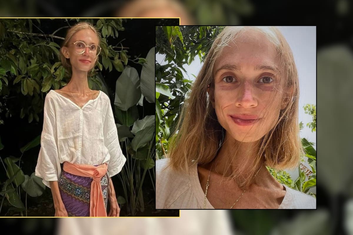 Influencer polaca que solo comía frutas crudas murió por desnutrición extrema en una reunión con otras personas que compartían su estilo de vida fuera de su país; tenía 39 años y pesaba 22 kilos