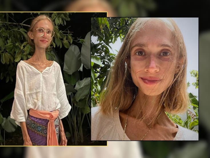 Influencer polaca que solo comía frutas crudas murió por desnutrición extrema en una reunión con otras personas que compartían su estilo de vida fuera de su país; tenía 39 años y pesaba 22 kilos