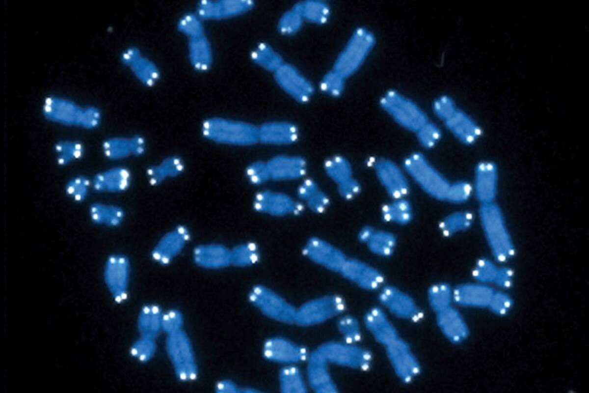 Descubren el gen responsable de un trastorno que causa discapacidad intelectual