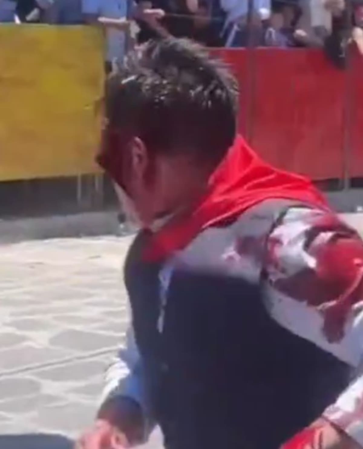 Un usuario de X compartió una fotografía que muestra cómo se desprendió la piel de una parte del rostro de Roberto Pozos. (Foto: Redes sociales)
