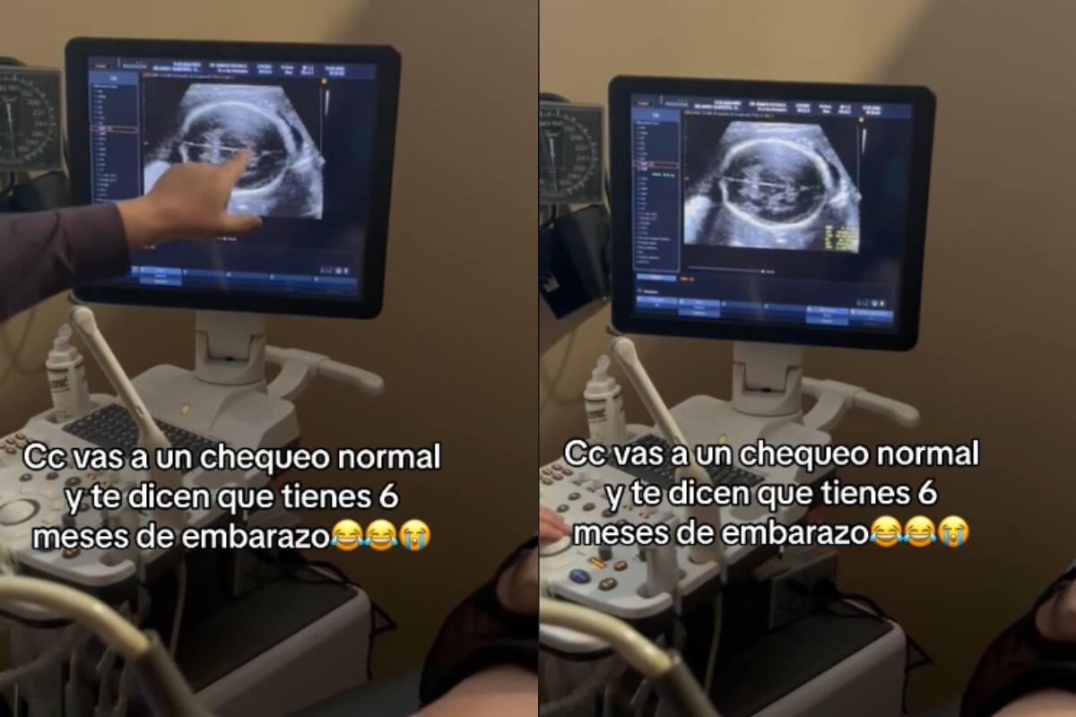 Mujer descubre inesperado embarazo de seis meses durante chequeo médico de rutina