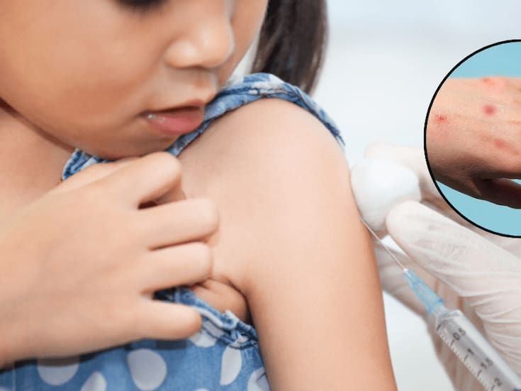 Suma sarampión más de 6 mil casos durante este año