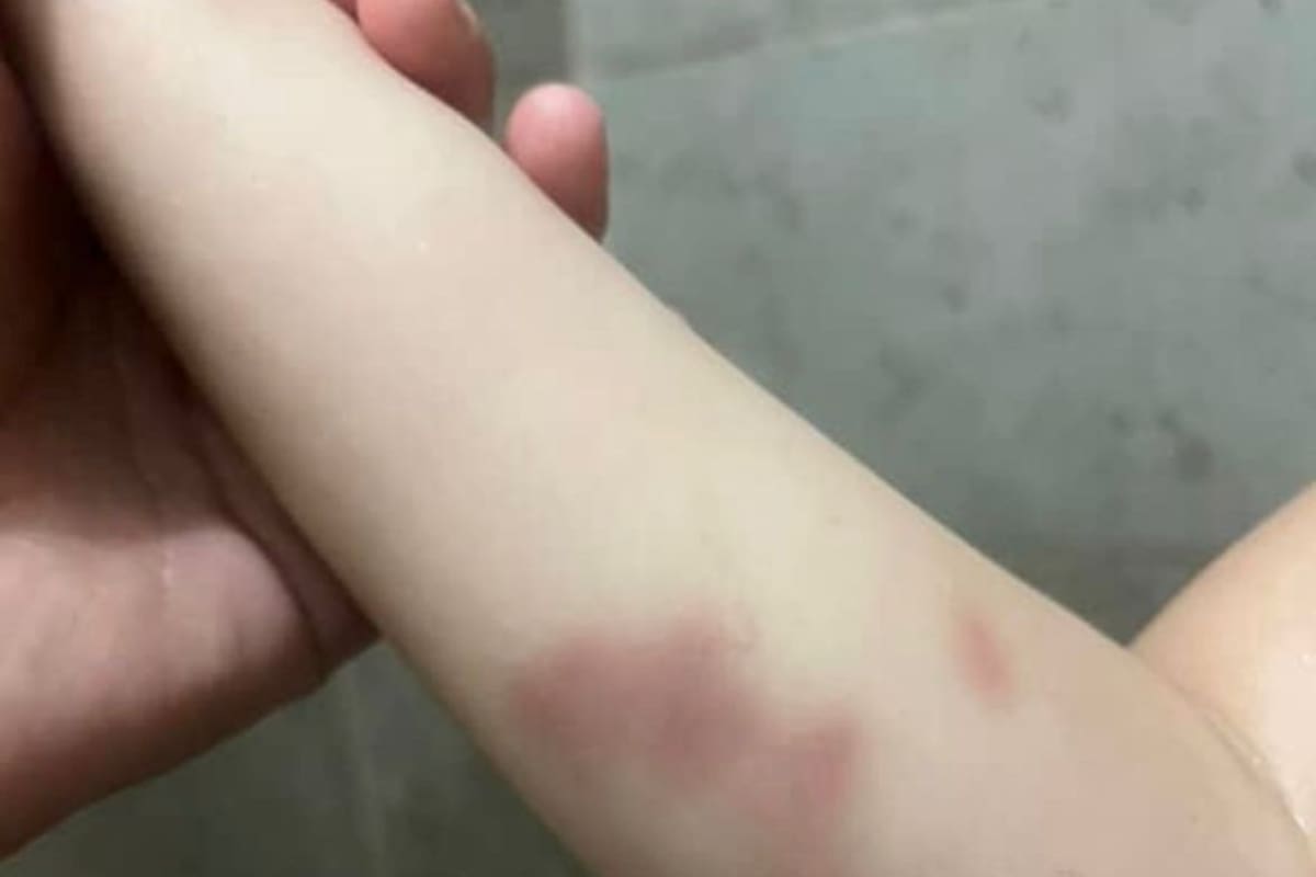 Madre denuncia presunto encubrimiento de bullyn en colegio
