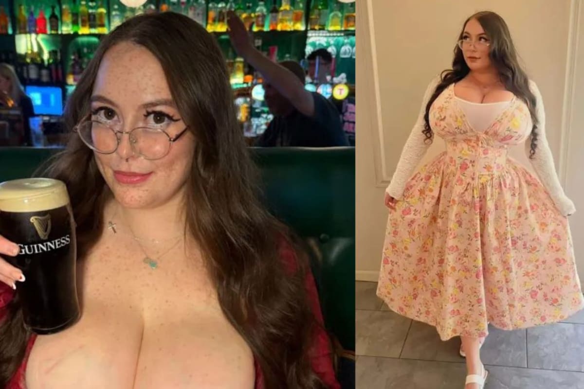 La escocesa de 28 años con senos de 25 kilos que no dejan de crecer: así es vivir con gigantomastia