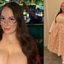 La escocesa de 28 años con senos de 25 kilos que no dejan de crecer: así es vivir con gigantomastia